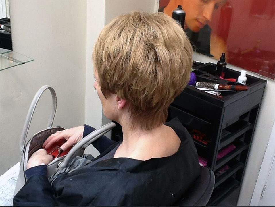 Hair loss - After