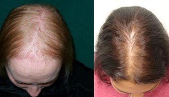 Before and After
